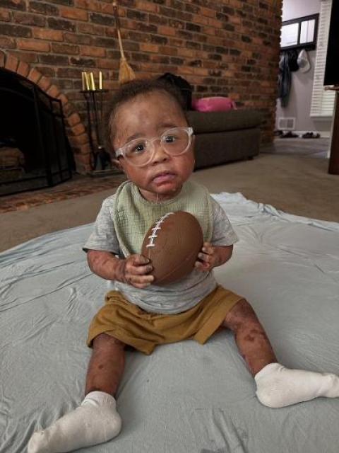 Miles Stewart Epidermolysis Bullosa NYC Marathon