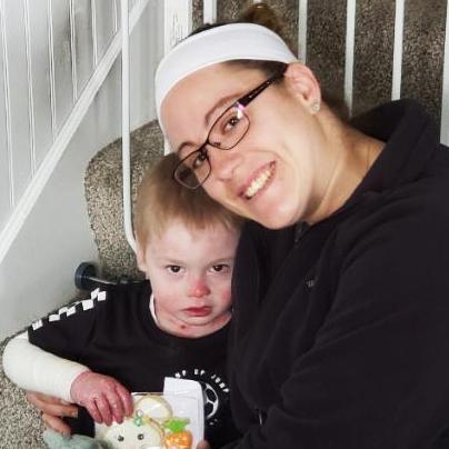 Epidermolysis Bullosa Personal Story