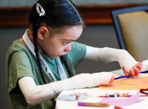 Child with Epidermolysis Bullosa