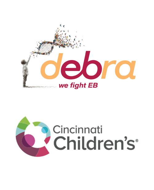 debra of America logo, Cincinnati Children's logo