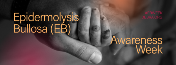 EB Awareness Week Social Media