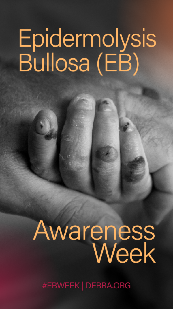 EB Awareness Week Social Media